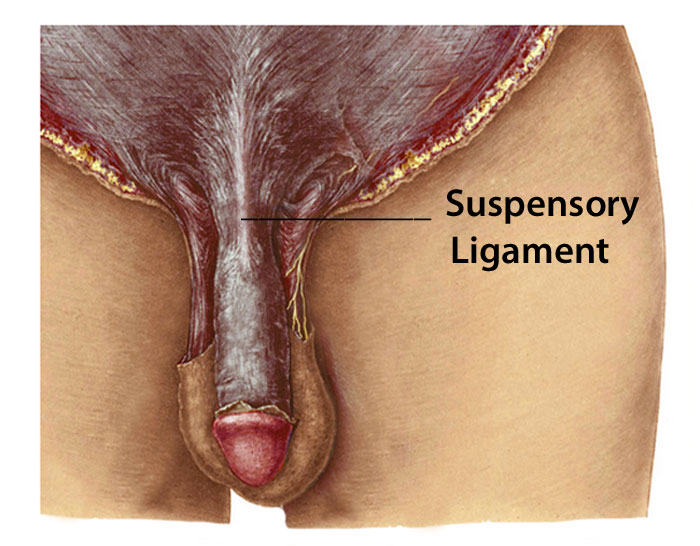 cutting the suspensory ligament attached to the penis